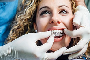 person having Invisalign appointment