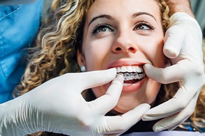 patient smiling while getting Invisalign