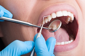 dentist looking at patient’s teeth 